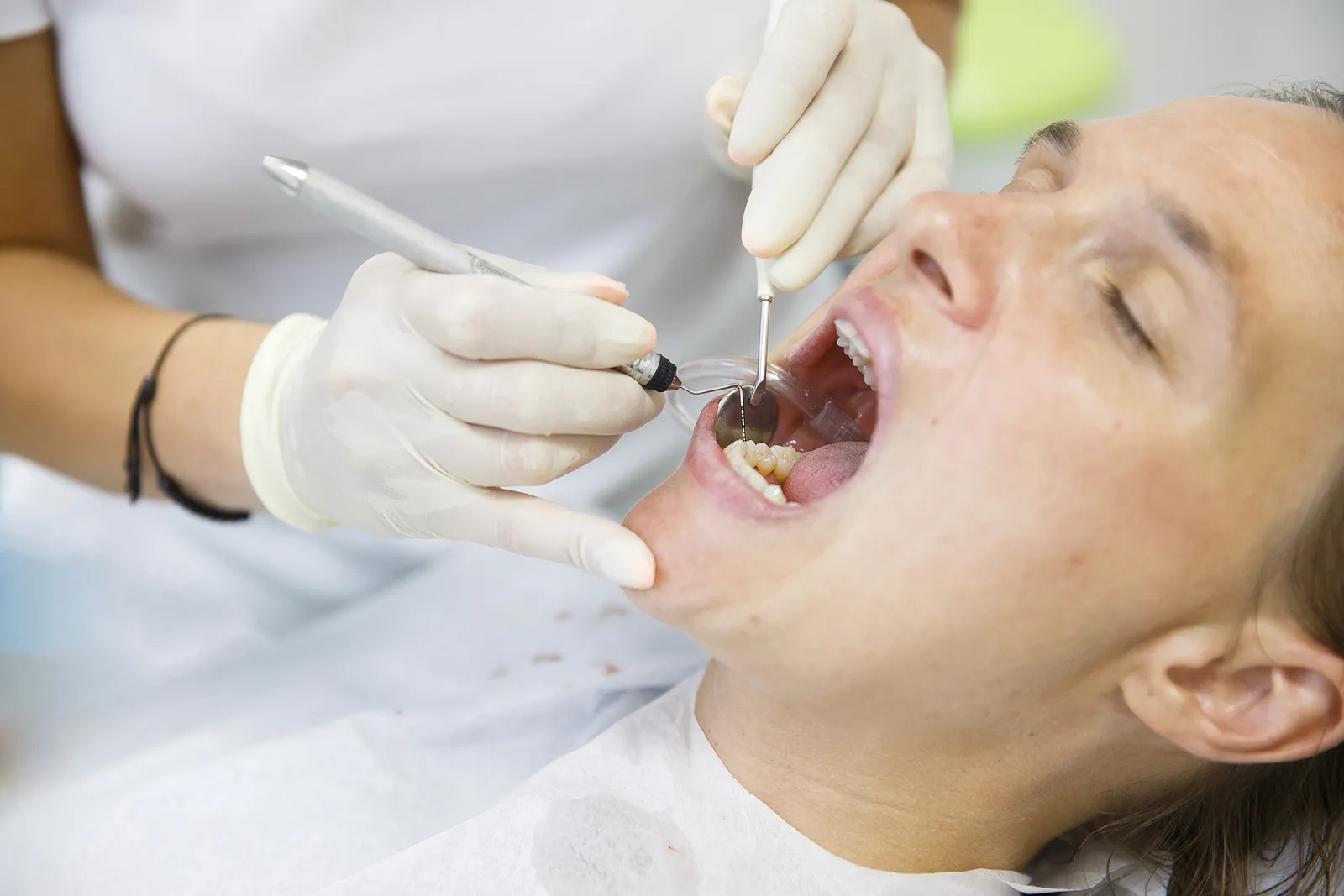 Essential Tips for a Smooth Recovery After Root Canal Treatment