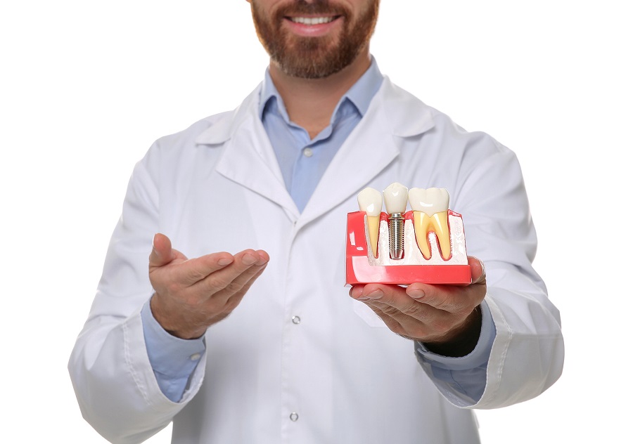 Dental Implants: The Best Solution for Missing Teeth