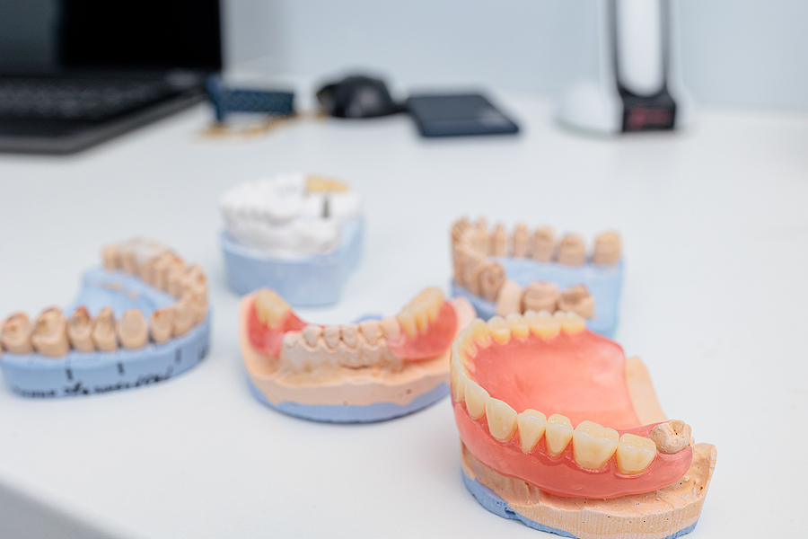 Restoring Your Smile with Dentures in Spanish Fork, UT: A Comprehensive Guide