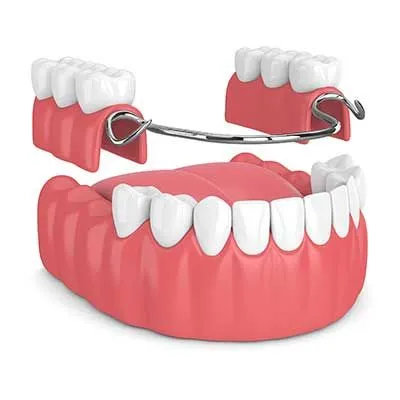 Dentistry Spanish Fork UT Denture Education Dental Model